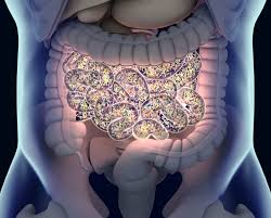 There is a bad bacteria in the colon that is related to Irritable Bowel Syndrome (IBS)